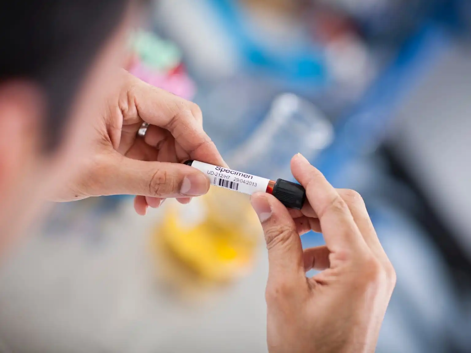 Blood sample label